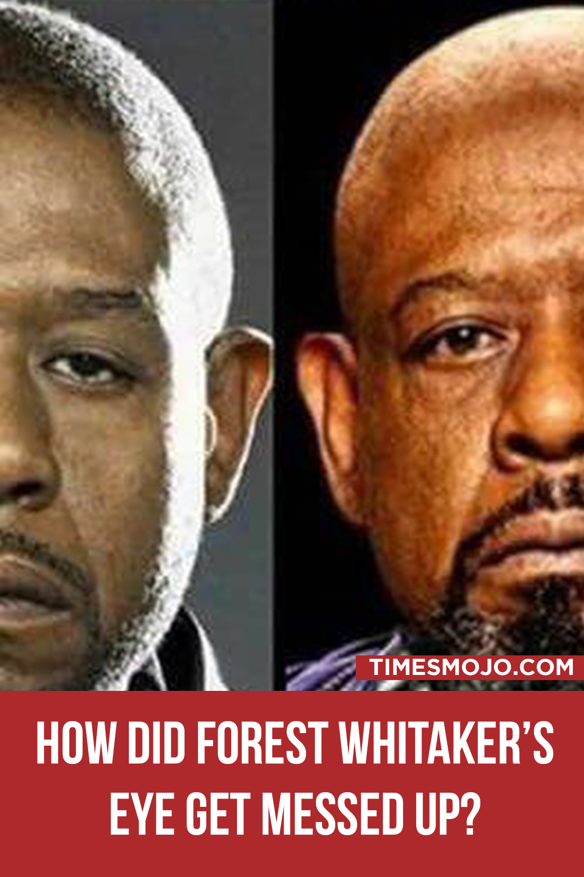 How Did Forest Whitaker’s Eye Get Messed Up